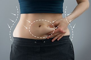 Tummy Tuck Surgery