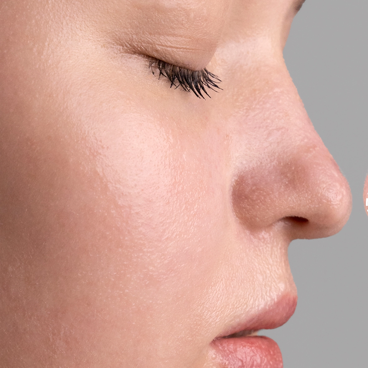 Side profile of a woman showing the healed and refined results of a Rhinoplasty Tip Reshaping procedure.