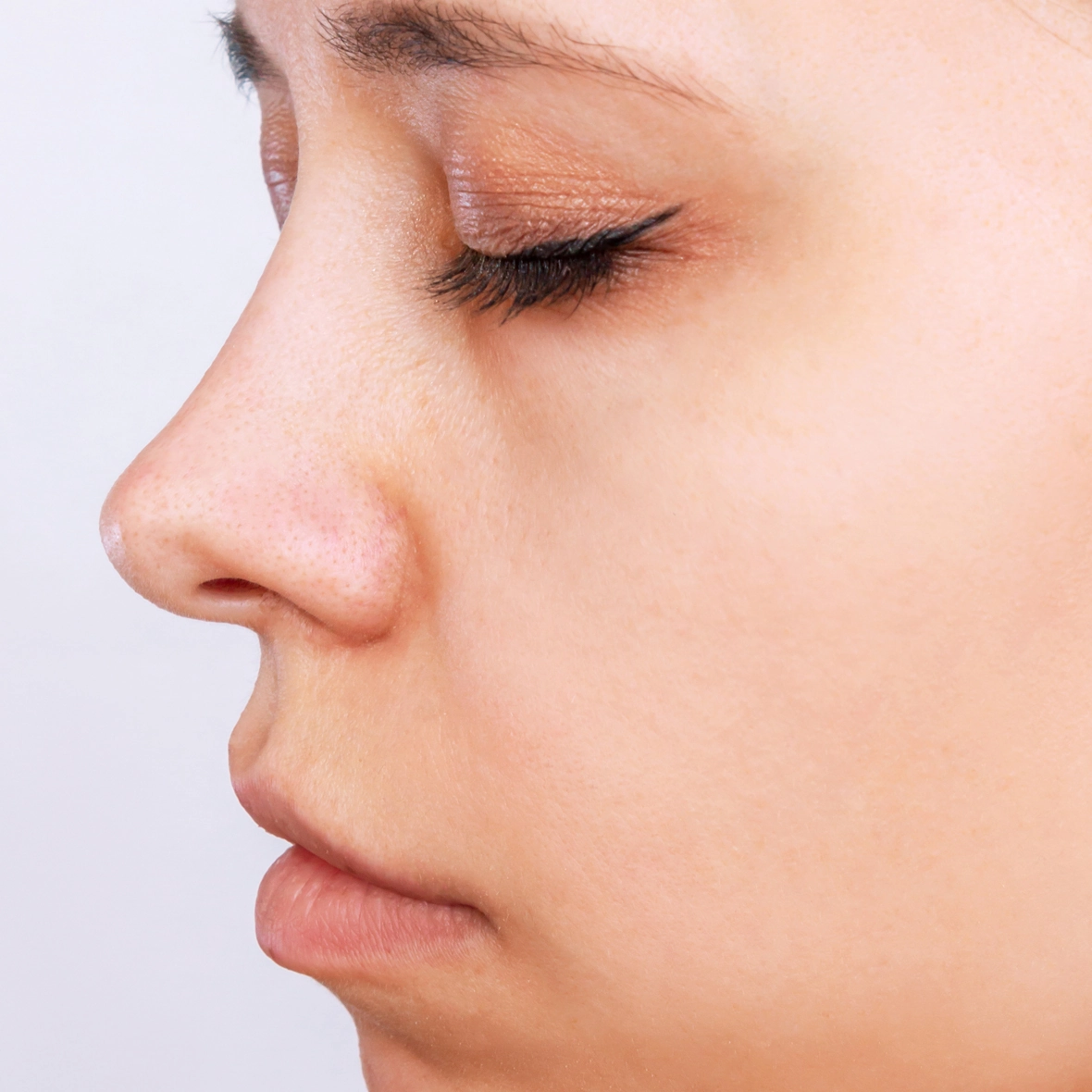 Profile view of a patient after Septoplasty surgery, showcasing a healed nasal structure and improved airway alignment.
