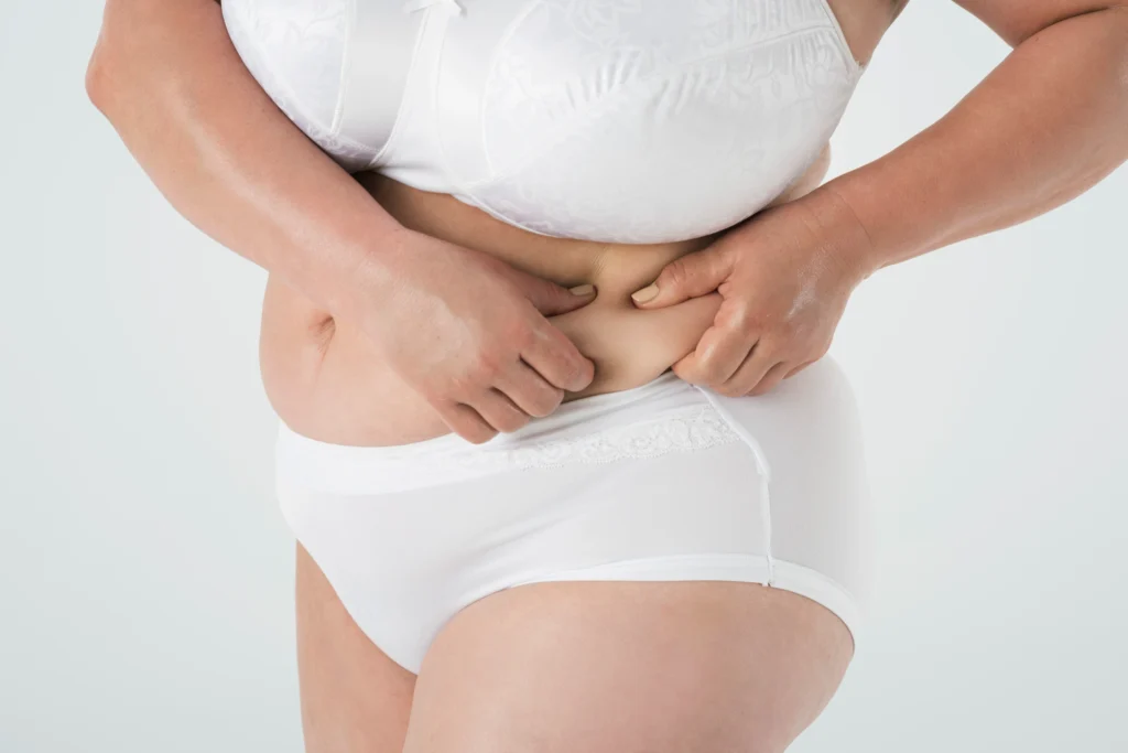 A woman in white underwear pinching the side of her waist to indicate fat removal areas for stomach liposuction in Dubai