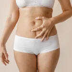 Clinical evaluation of the umbilical stalk and midline fascia for Umbilical Transposition in Abdominoplasty dubai.