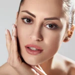 Postoperative maturation of dermal tissue and orbital symmetry following the BEST Eyes and Lips Lift Dubai.