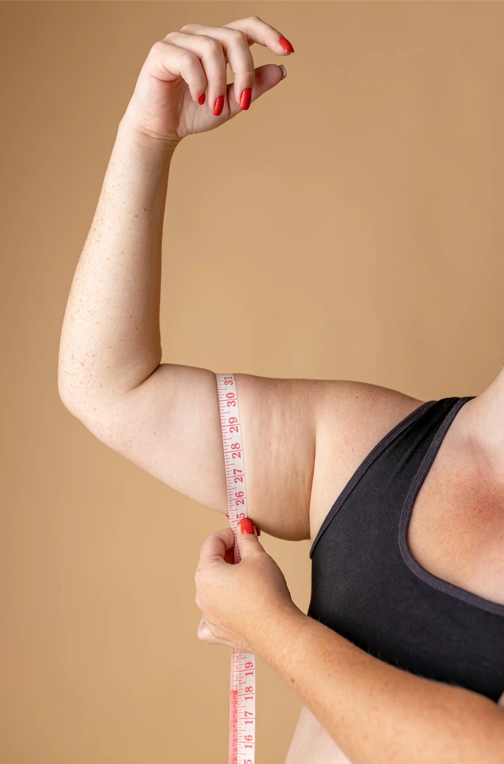 Clinical measurement of the medial brachial compartment for an Arm Lift in Dubai.