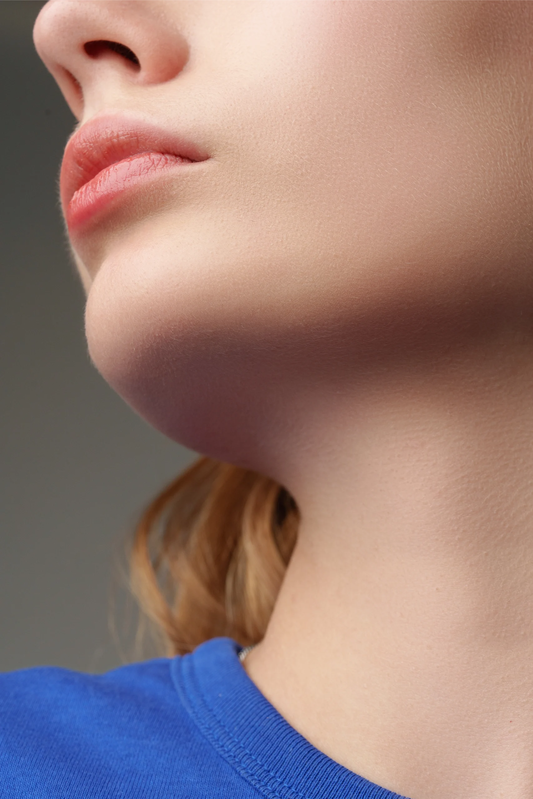 A submental anatomical view illustrating the target area for advanced surgical Double Chin Liposuction in Dubai.