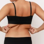 Posterior clinical evaluation of the thoracolumbar fascia to determine Techniques Used for Back Fat Removal in Dubai.
