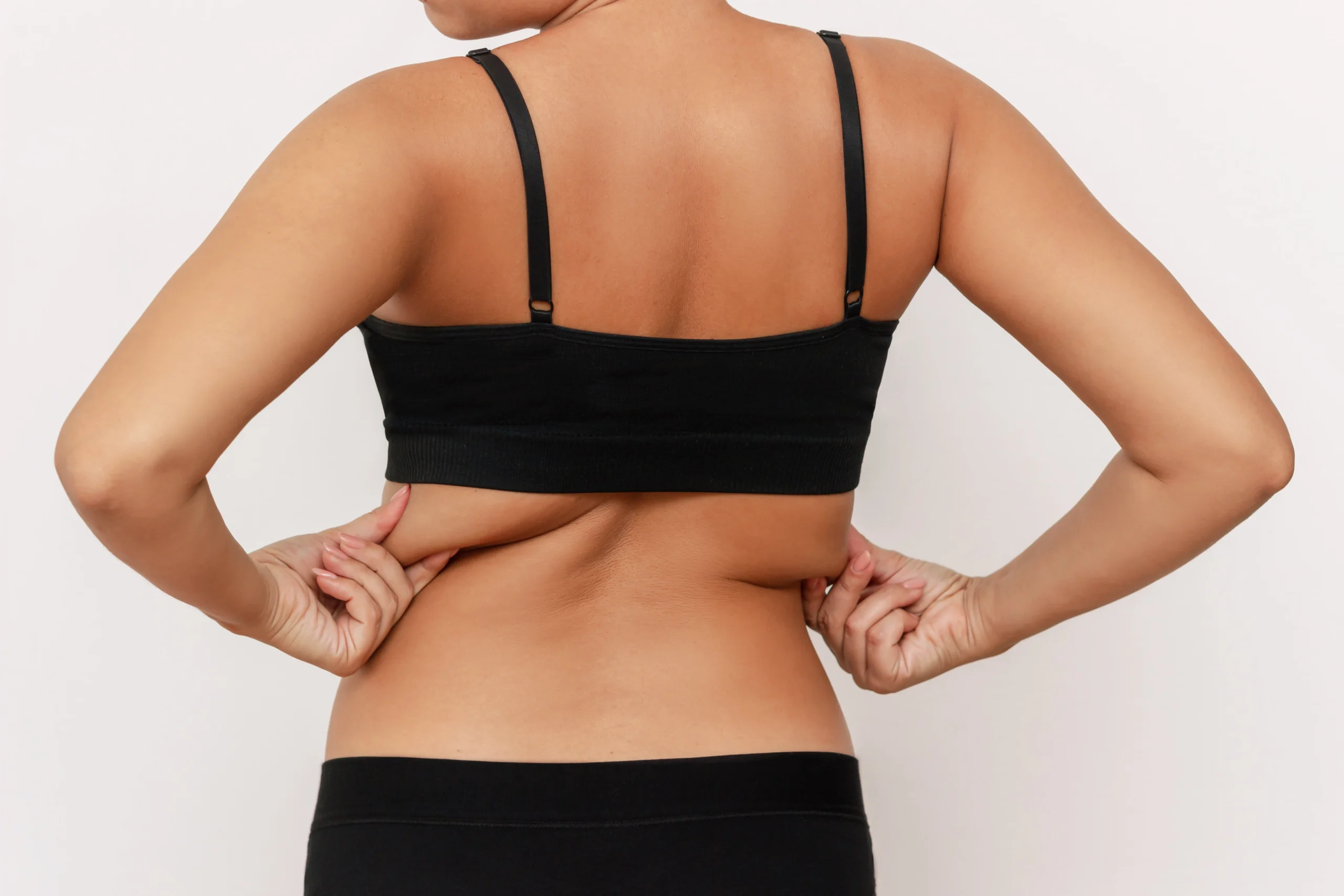 Posterior clinical evaluation of the thoracolumbar fascia to determine Techniques Used for Back Fat Removal in Dubai.