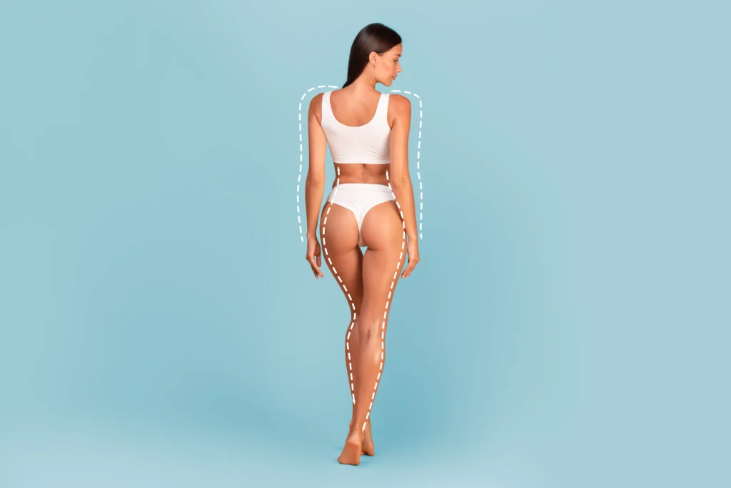 Posterior-lateral view of the gluteal Maximus and trochanteric region for Brazilian Butt Lift Dubai.