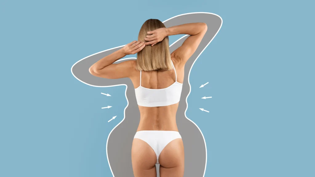 Detailed posterior anatomical markings for targeted adipose resection in Back Liposuction Dubai.