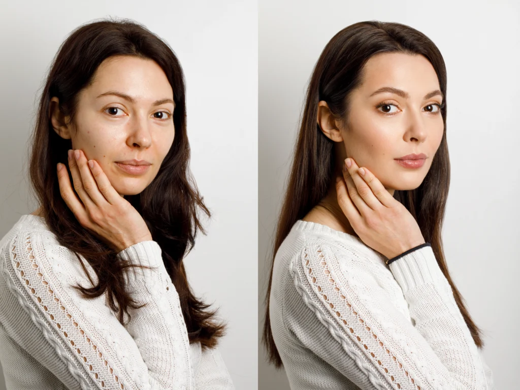 A side-by-side portrait comparison of a woman showing a tired appearance on the left and a rejuvenated, youthful appearance with lifted contours on the right after a natural facelift by Dr. Sanjay Parashar.