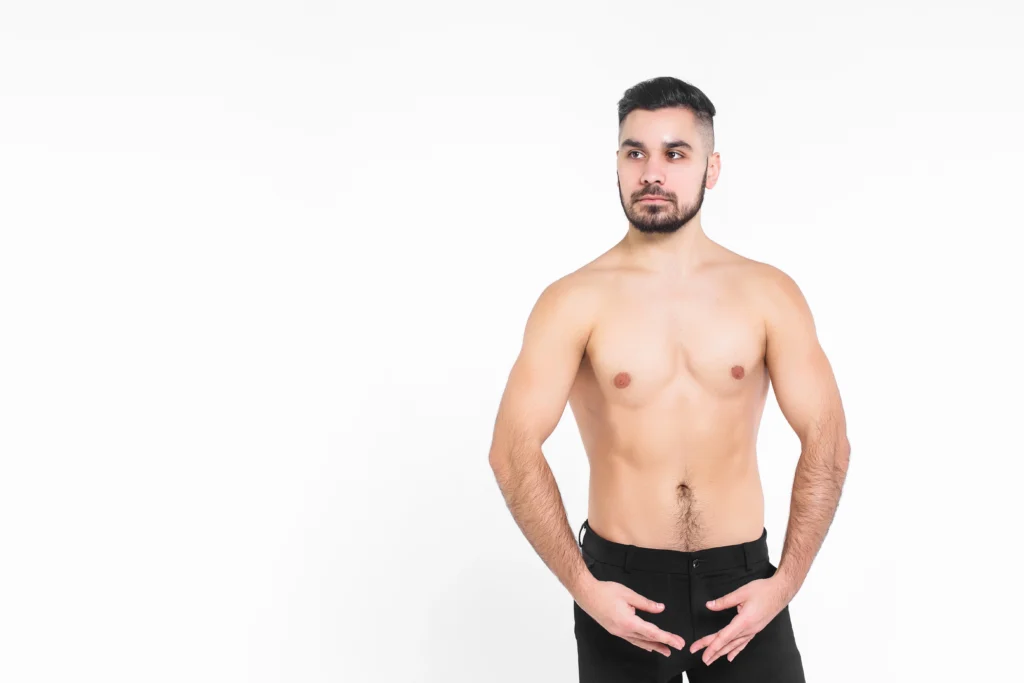 Pre-operative vector mapping of the abdominal, flank, and anterior thigh territories to prepare a female patient for a multi-zone V Sculpt Liposuction in Dubai.