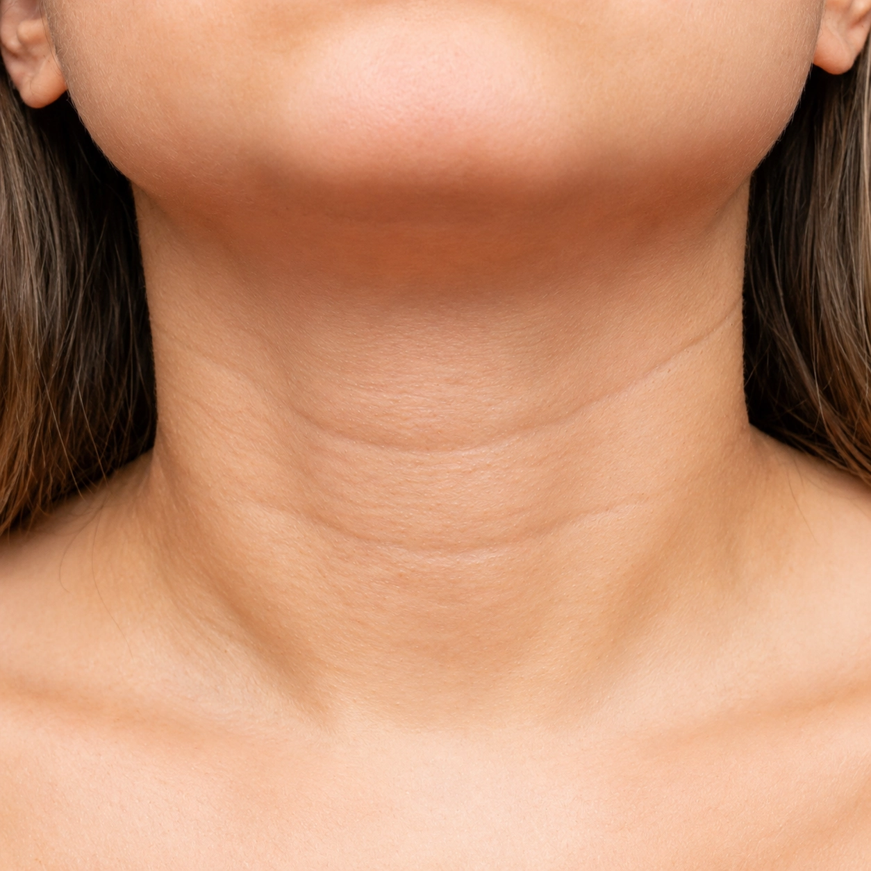 Before neck lift surgery results at Cocoona Dubai