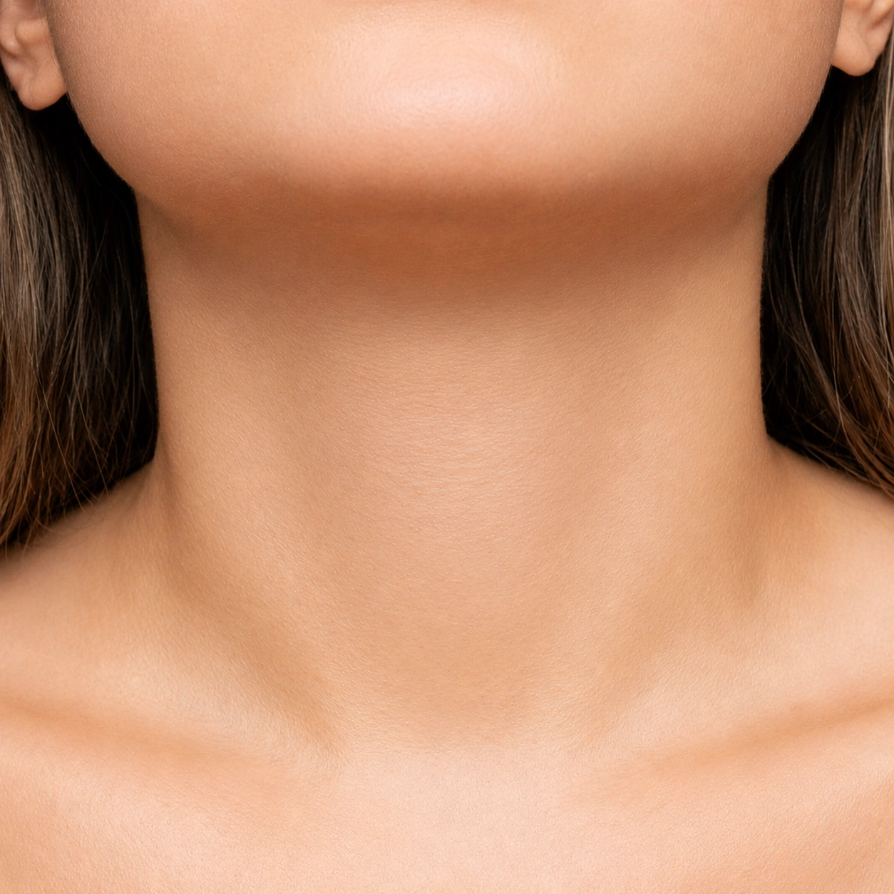 After neck lift platysmaplasty results at Cocoona Dubai