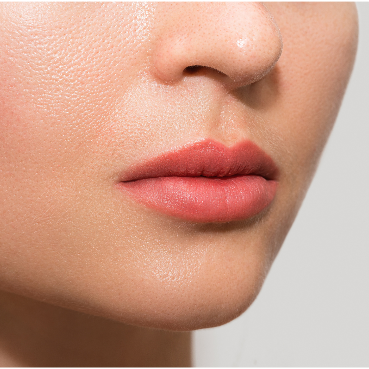 A detailed clinical close-up front view of a woman's lower face, nose, and mouth against a neutral gray background, showcasing a significantly shortened distance between the base of the nose and the upper lip vermilion border, along with increased upper lip volume following a Lips Lift dubai.