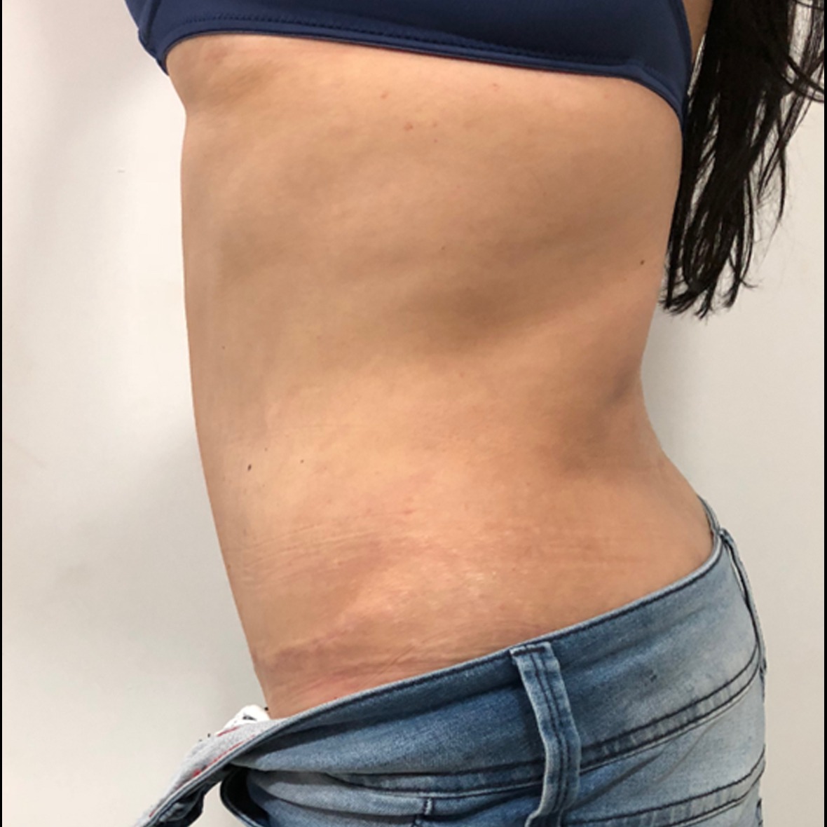 A side profile view of a woman's torso from the chest to the upper hips standing against a white background, wearing a blue sports bra and low-slung denim jeans to display a flat lower stomach achieved after a Mini Abdominoplasty in Dubai.