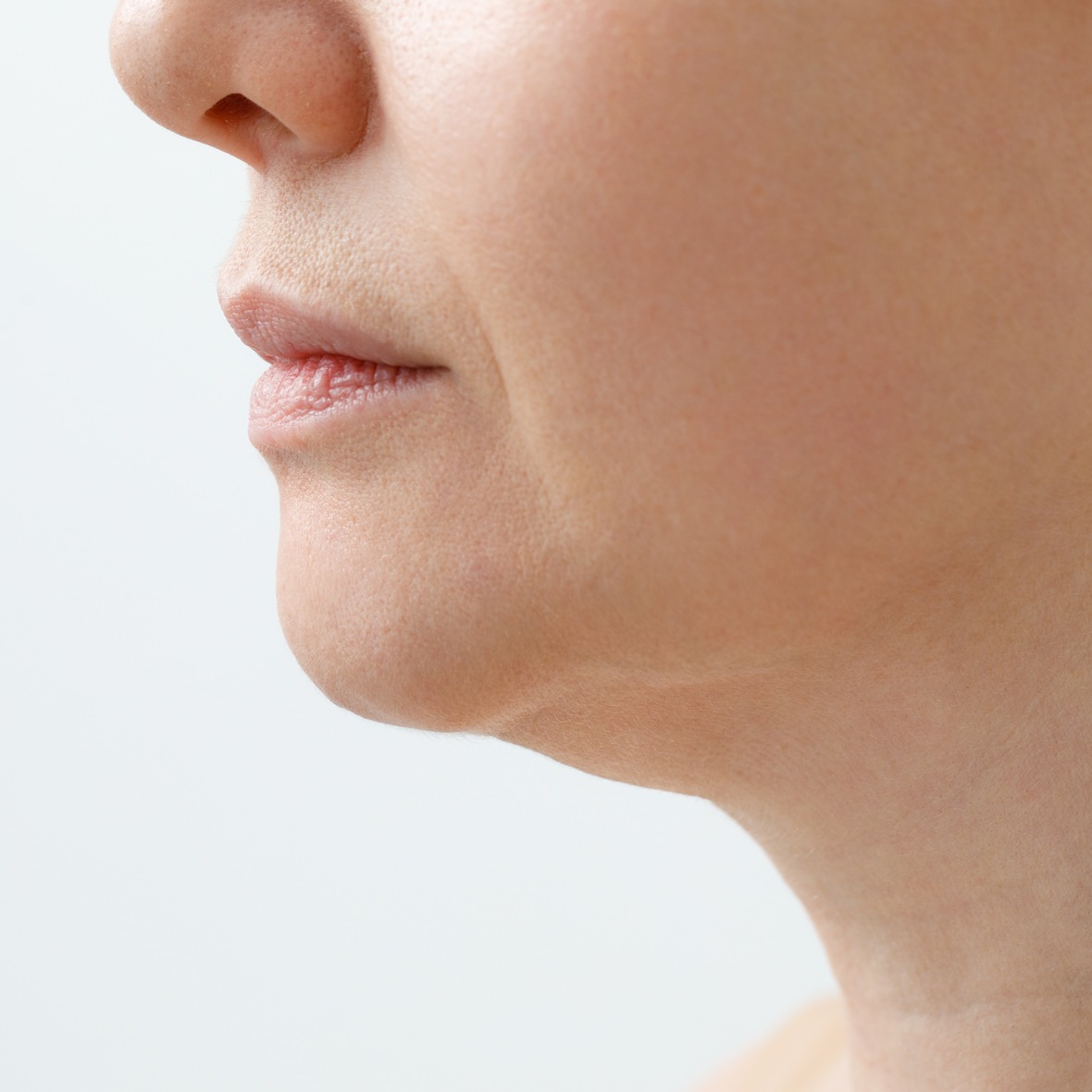A close-up three-quarters side profile view of a person's lower face, lips, jawline, and neck against a plain white background, showcasing rounded fullness in the lower cheek and submental area to establish a baseline for Buccal Fat Removal in Dubai.