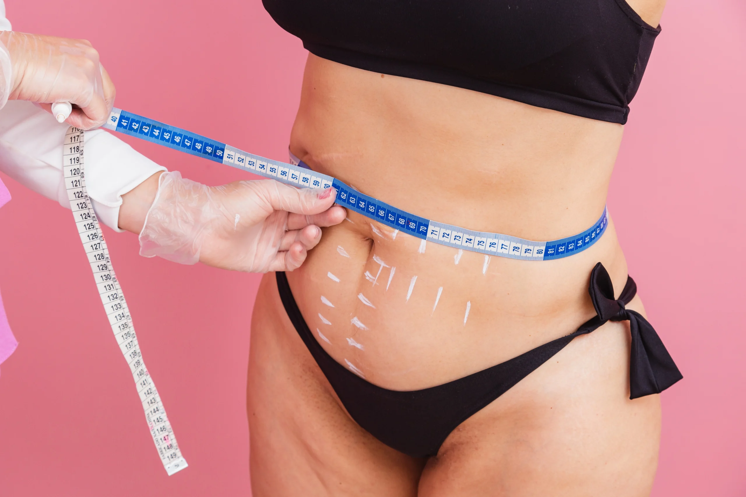 A close-up side view of a woman standing in a black sports bra and bikini bottoms against a pink background, while a practitioner's gloved hands wrap a blue and white tape measure around her marked stomach to track liposuction dubai recovery.
