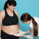 A three-quarters clinical view of a patient standing against a cyan background while a female surgeon in a white medical coat and sterile gloves uses a marker to draw precise preoperative incision lines across the lower abdomen to plan a Mommy Makeover Surgery Dubai.
