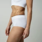 A side profile view of a woman standing in white high-waisted briefs and a crop top against a grey studio backdrop, featuring black dashed guidelines, shaded zones, and vector arrows on her flank and upper thigh to plan Body Contouring Dubai.