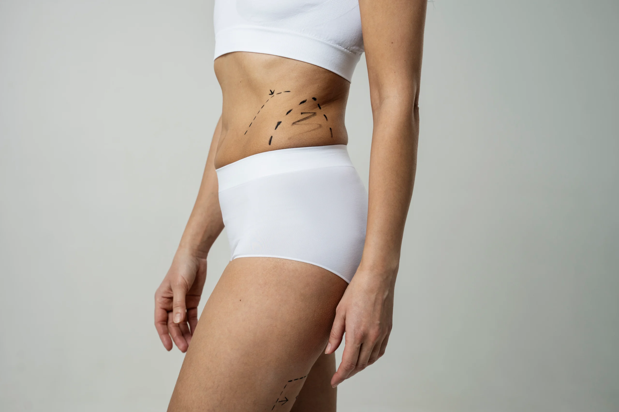 A side profile view of a woman standing in white high-waisted briefs and a crop top against a grey studio backdrop, featuring black dashed guidelines, shaded zones, and vector arrows on her flank and upper thigh to plan Body Contouring Dubai.