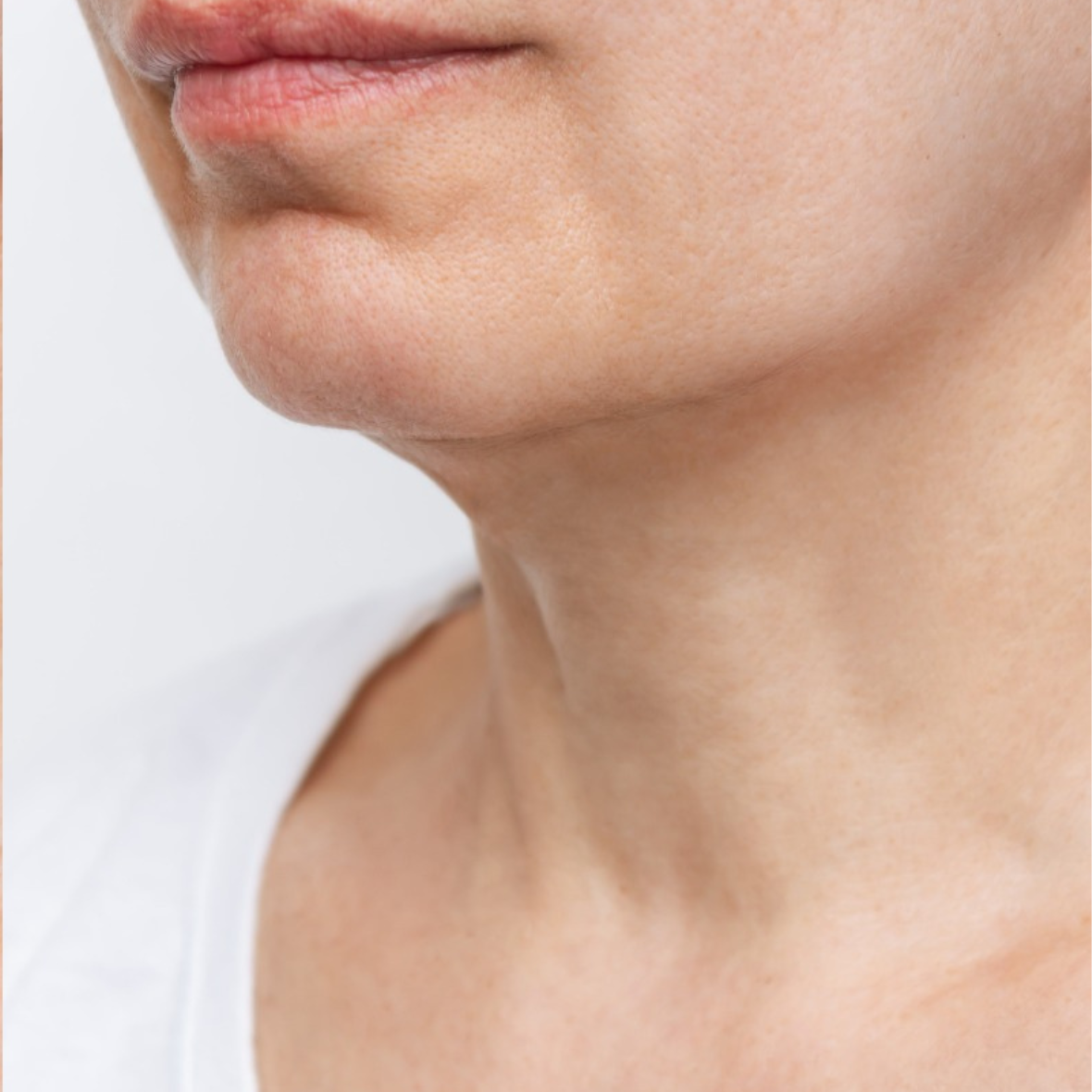 after Neck Lift in Dubai at cocoona