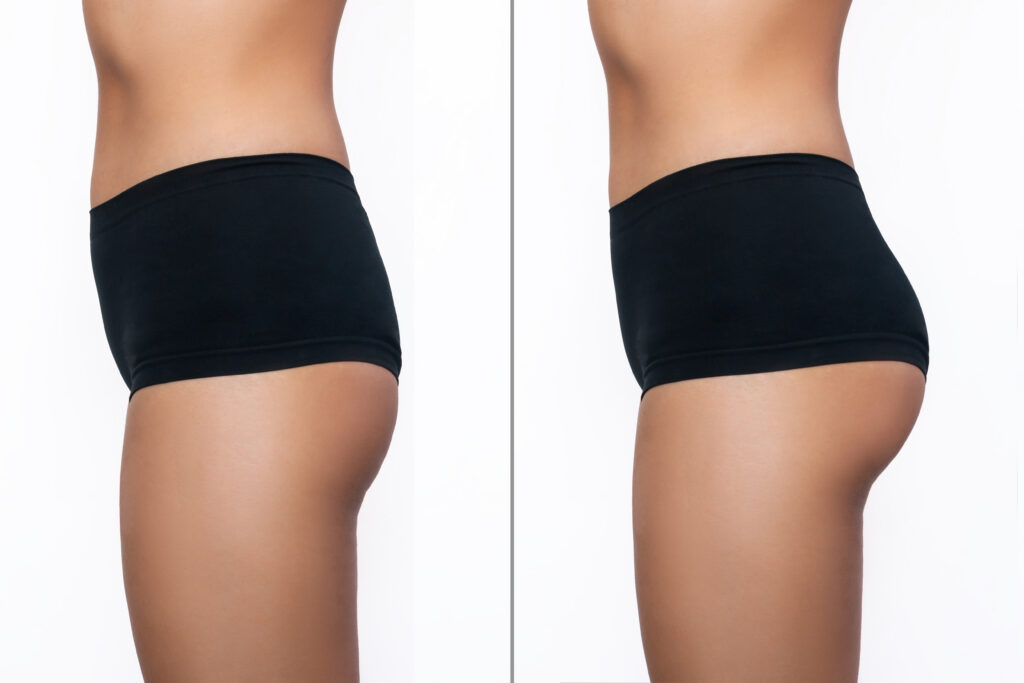 cropped-shot-young-slim-woman-with-buttocks-before-after-sports-training-white-background