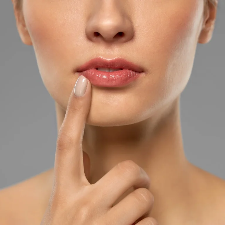 Surgical visualization of the subnasal incision and orbicularis oris suspension for a Lip Lift Procedure in Dubai.