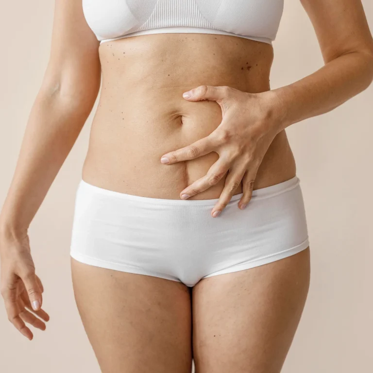 Clinical evaluation of the umbilical stalk and midline fascia for Umbilical Transposition in Abdominoplasty dubai.