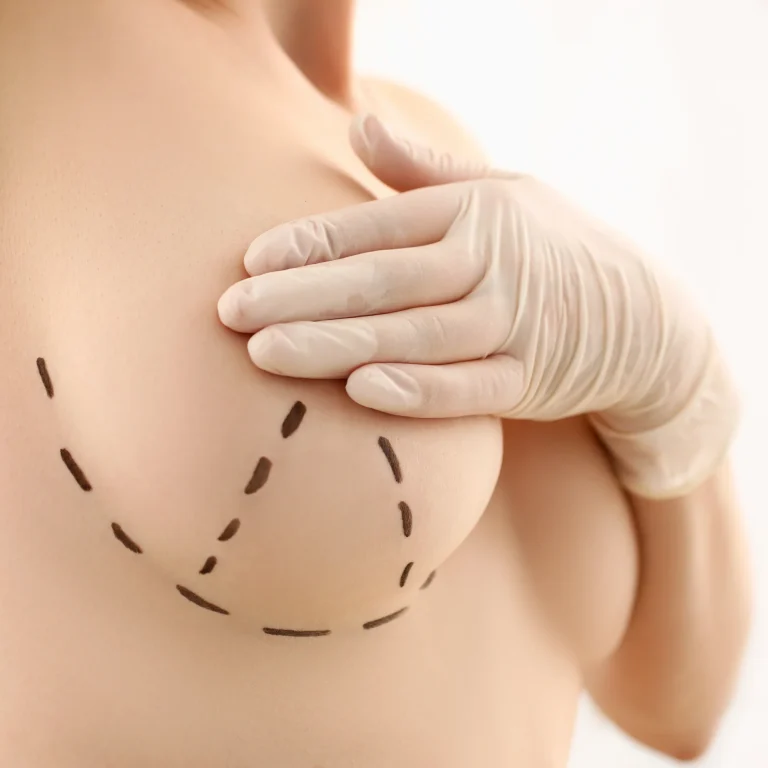 Palpation of the mammary envelope during the initial phase of Recovery After Breast Augmentation in Dubai.