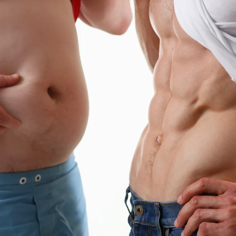 Side-by-side clinical comparison of generalized abdominal adipose reduction versus high-definition abdominal etching.